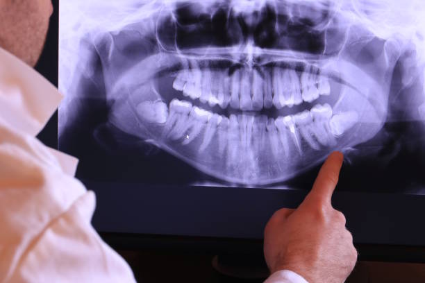 Best Emergency Treatment for Toothache in Steelton, PA